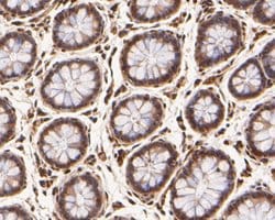 Invitrogen p21 ARC Polyclonal Antibody 100 &mu;L; Unconjugated:Antibodies,