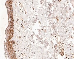 Invitrogen TMX4 Polyclonal Antibody 100 &mu;L; Unconjugated:Antibodies,