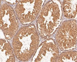 Invitrogen TMX4 Polyclonal Antibody 100 &mu;L; Unconjugated:Antibodies,