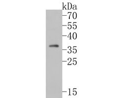 Invitrogen TMX4 Polyclonal Antibody 100 &mu;L; Unconjugated:Antibodies,
