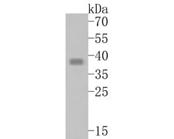 Invitrogen TMX4 Polyclonal Antibody 100 &mu;L; Unconjugated:Antibodies,