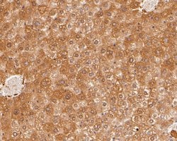 Invitrogen HPD Polyclonal Antibody 100 &mu;L; Unconjugated:Antibodies,