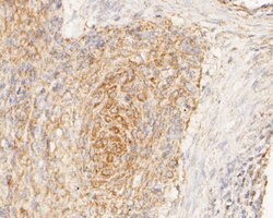 Invitrogen GRIK4 Polyclonal Antibody 100 &mu;L; Unconjugated:Antibodies,