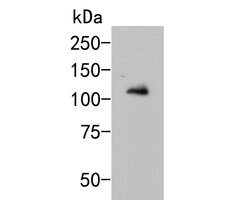 Invitrogen GRIK4 Polyclonal Antibody 100 &mu;L; Unconjugated:Antibodies,