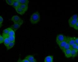 Invitrogen SAPAP1 Polyclonal Antibody 100 &mu;L; Unconjugated:Antibodies,