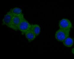 Invitrogen SAPAP1 Polyclonal Antibody 100 &mu;L; Unconjugated:Antibodies,