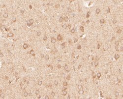 Invitrogen SAPAP1 Polyclonal Antibody 100 &mu;L; Unconjugated:Antibodies,