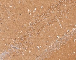 Invitrogen SAPAP1 Polyclonal Antibody 100 &mu;L; Unconjugated:Antibodies,