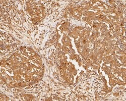 Invitrogen PDCD6 Polyclonal Antibody 100 &mu;L; Unconjugated:Antibodies,