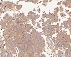 Invitrogen PDCD6 Polyclonal Antibody 100 &mu;L; Unconjugated:Antibodies,
