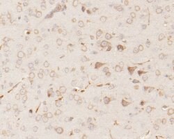 Invitrogen RARS Polyclonal Antibody 100 &mu;L; Unconjugated:Antibodies,