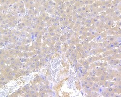 Invitrogen Factor IX Polyclonal Antibody 100 &mu;L | Buy Online | Invitrogen&trade; | Fisher Scientific