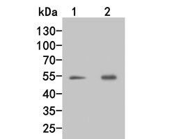 Invitrogen Factor IX Polyclonal Antibody 100 &mu;L | Buy Online | Invitrogen&trade; | Fisher Scientific