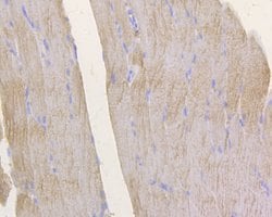 Invitrogen GFPT1 Polyclonal Antibody 100 &mu;L; Unconjugated:Antibodies,