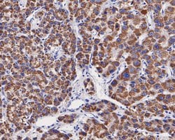 Invitrogen OTC Polyclonal Antibody 100 &mu;L; Unconjugated:Antibodies,