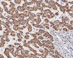 Invitrogen OTC Polyclonal Antibody 100 &mu;L; Unconjugated:Antibodies,