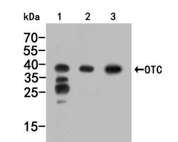 Invitrogen OTC Polyclonal Antibody 100 &mu;L; Unconjugated:Antibodies,