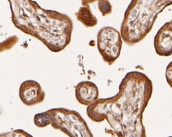 Invitrogen ADK Polyclonal Antibody 100 &mu;L; Unconjugated:Antibodies,