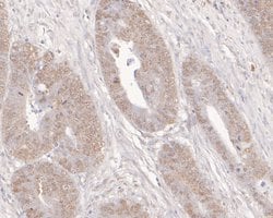 Invitrogen ADK Polyclonal Antibody 100 &mu;L; Unconjugated:Antibodies,