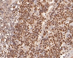 Invitrogen ADK Polyclonal Antibody 100 &mu;L; Unconjugated:Antibodies,
