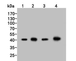 Invitrogen ADK Polyclonal Antibody 100 &mu;L; Unconjugated:Antibodies,