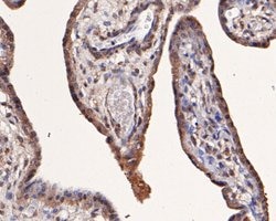 Invitrogen Munc13-4 Polyclonal Antibody 100 &mu;L; Unconjugated:Antibodies,