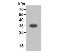 Invitrogen SULT1E1 Polyclonal Antibody 100 &mu;L; Unconjugated:Antibodies,
