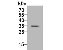 Invitrogen SULT1E1 Polyclonal Antibody 100 &mu;L; Unconjugated:Antibodies,