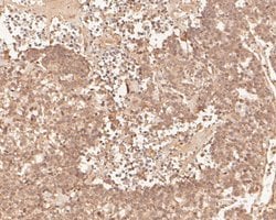 Invitrogen PHLDA1 Polyclonal Antibody 100 &mu;L; Unconjugated:Antibodies,