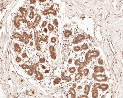 Invitrogen PHLDA1 Polyclonal Antibody 100 &mu;L; Unconjugated:Antibodies,