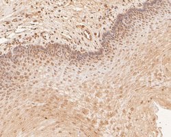 Invitrogen PHLDA1 Polyclonal Antibody 100 &mu;L; Unconjugated:Antibodies,