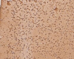 Invitrogen PHLDA1 Polyclonal Antibody 100 &mu;L; Unconjugated:Antibodies,