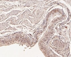 Invitrogen CHMP2A Polyclonal Antibody 100 &mu;L | Buy Online | Invitrogen&trade; | Fisher Scientific