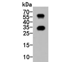 Invitrogen CD69 Polyclonal Antibody 100 &mu;L; Unconjugated:Antibodies,