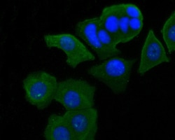 Invitrogen Syk Polyclonal Antibody 100 μL; Unconjugated:Antibodies,