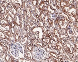 Invitrogen Syk Polyclonal Antibody 100 μL; Unconjugated:Antibodies,