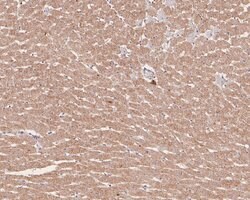 Invitrogen Syk Polyclonal Antibody 100 μL; Unconjugated:Antibodies,