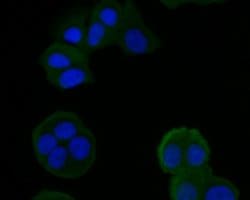 Invitrogen HSD3B1 Polyclonal Antibody 100 μL; Unconjugated:Antibodies,