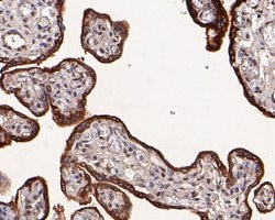Invitrogen HSD3B1 Polyclonal Antibody 100 μL; Unconjugated:Antibodies,
