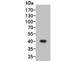 Invitrogen HSD3B1 Polyclonal Antibody 100 μL; Unconjugated:Antibodies,