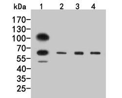 Invitrogen GABRG1 Polyclonal Antibody 100 &mu;L; Unconjugated:Antibodies,