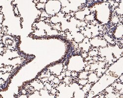 Invitrogen Ly-6C Polyclonal Antibody 100 &mu;L; Unconjugated:Antibodies,