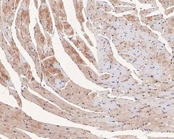 Invitrogen Ly-6C Polyclonal Antibody 100 &mu;L; Unconjugated:Antibodies,