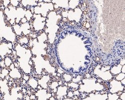 Invitrogen Ly-6C Polyclonal Antibody 100 &mu;L; Unconjugated:Antibodies,