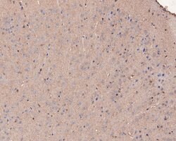 Invitrogen Ly-6C Polyclonal Antibody 100 &mu;L; Unconjugated:Antibodies,