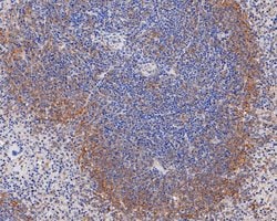 Invitrogen Ly-6C Polyclonal Antibody 100 &mu;L; Unconjugated:Antibodies,
