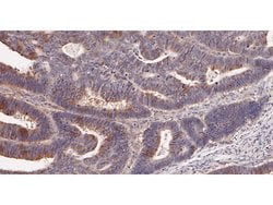 Invitrogen ADSL Polyclonal Antibody 100 &mu;L; Unconjugated:Antibodies,