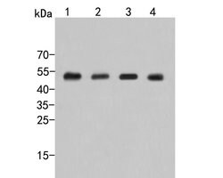 Invitrogen ADSL Polyclonal Antibody 100 &mu;L; Unconjugated:Antibodies,