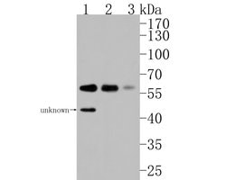 Invitrogen p70 S6 Kinase beta Polyclonal Antibody 100 &mu;L | Buy Online | Invitrogen&trade; | Fisher Scientific