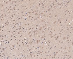 Invitrogen ATG14 Polyclonal Antibody 100 &mu;L; Unconjugated:Antibodies,